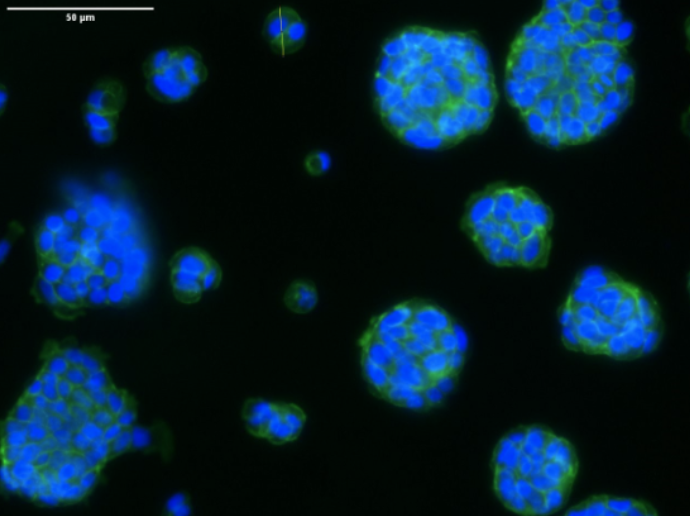 Nuclei Fluorescence Microscopy